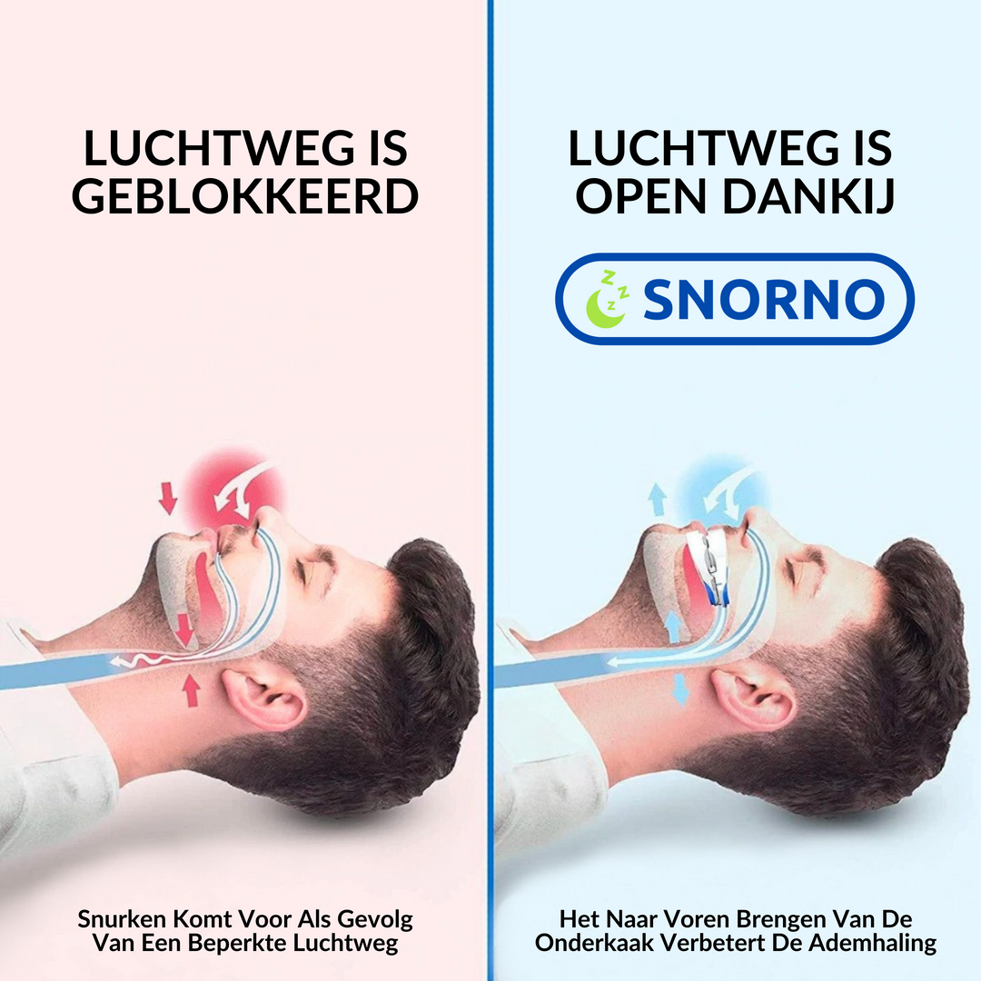 Anti-Snurk Beugel voor snurkpreventie, gemaakt van zacht hypoallergeen materiaal, biedt comfort en bevordert betere nachtrust