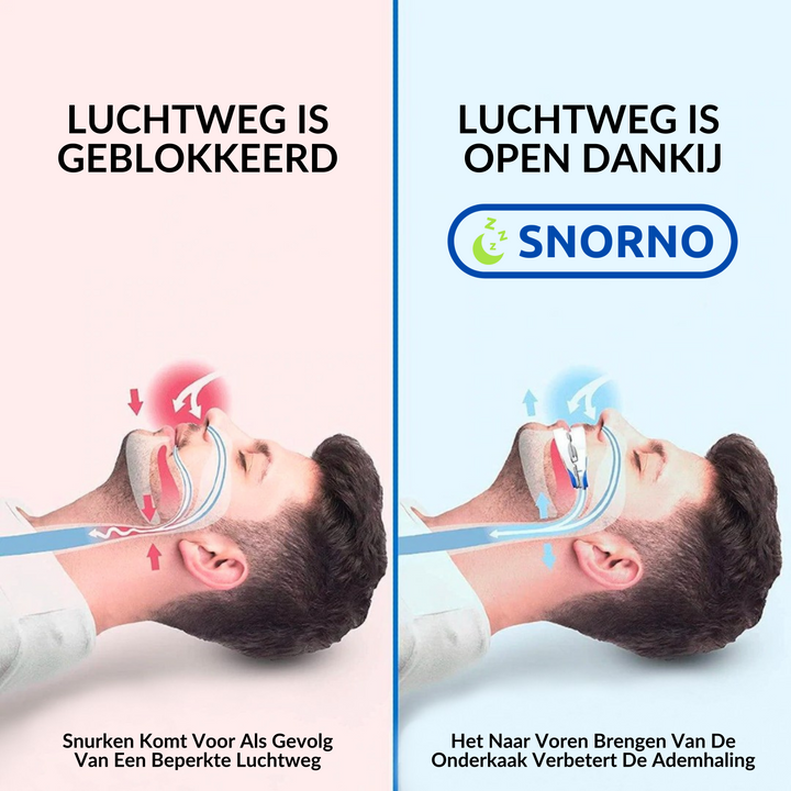Anti-Snurk Beugel voor snurkpreventie, gemaakt van zacht hypoallergeen materiaal, biedt comfort en bevordert betere nachtrust