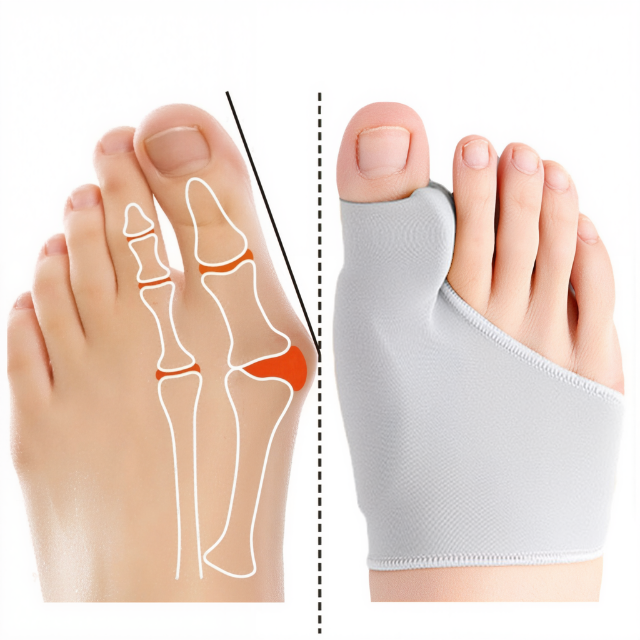 "Grijze gelpad bunion corrector, ergonomisch design voor voetpijnverlichting en comfortabel gebruik in diverse schoenen."